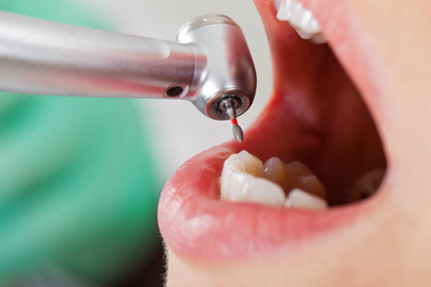 Best Mobile Emergency Dentist in Antlers, OK